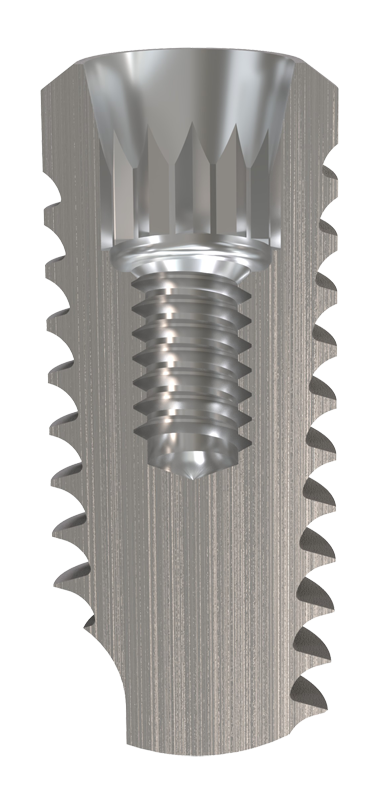 Prio Plus Implant