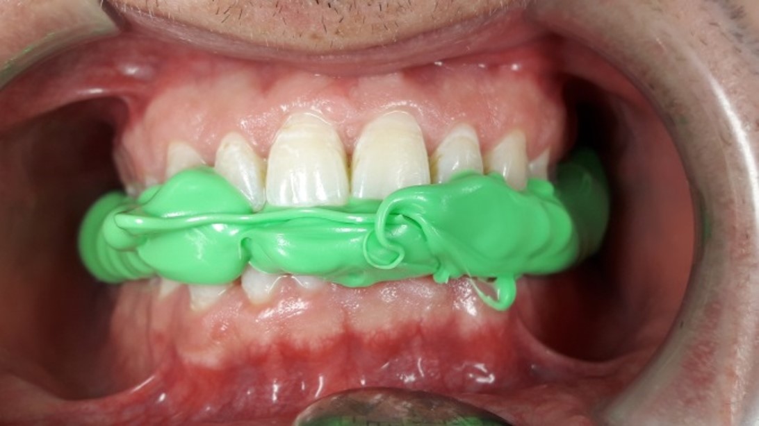 Hydroline thixotroop Key