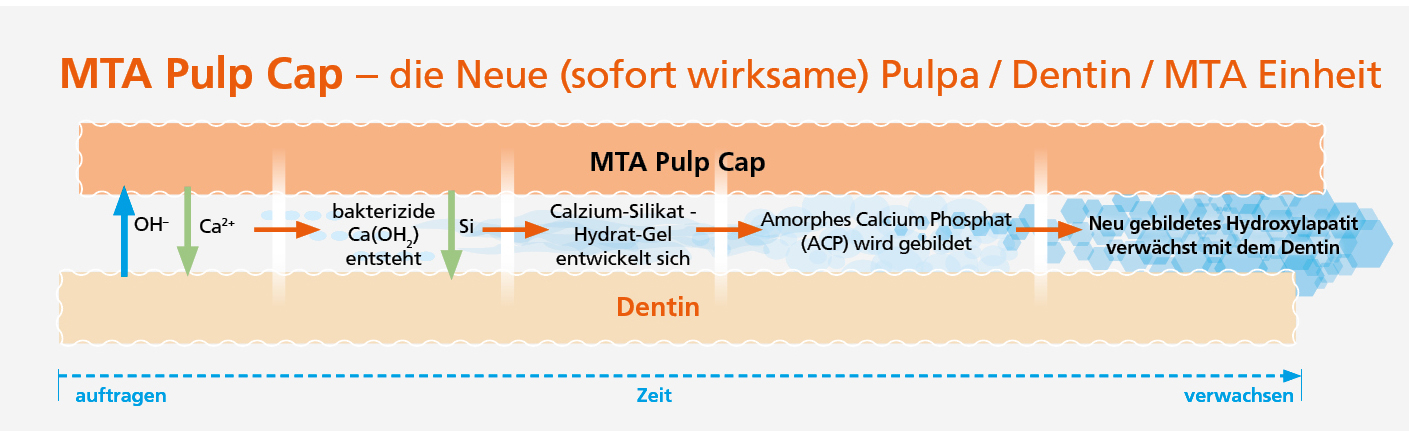 MTA PulpCap