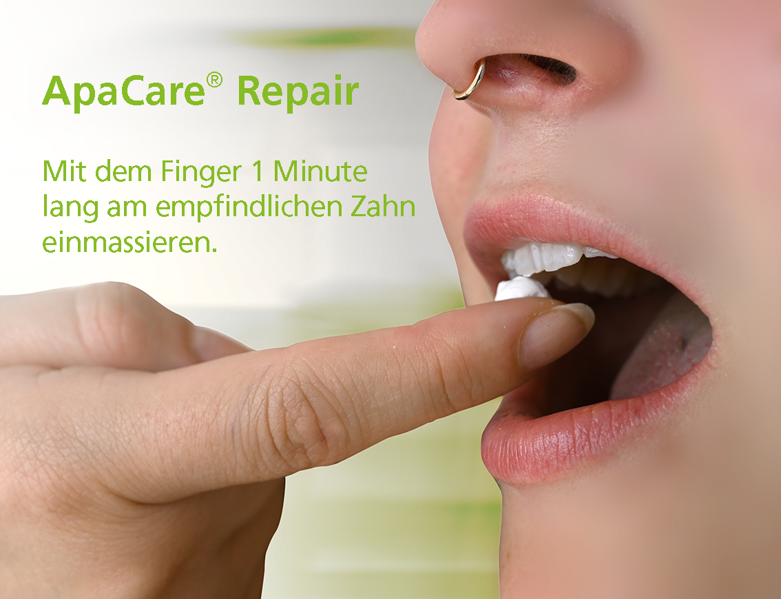 Reparatie Tandheelkundige reparatiepasta